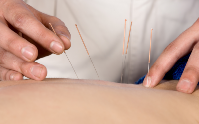 Acupuncturist Silently Invokes “Fingers Crossed” Prayer With Each Needle