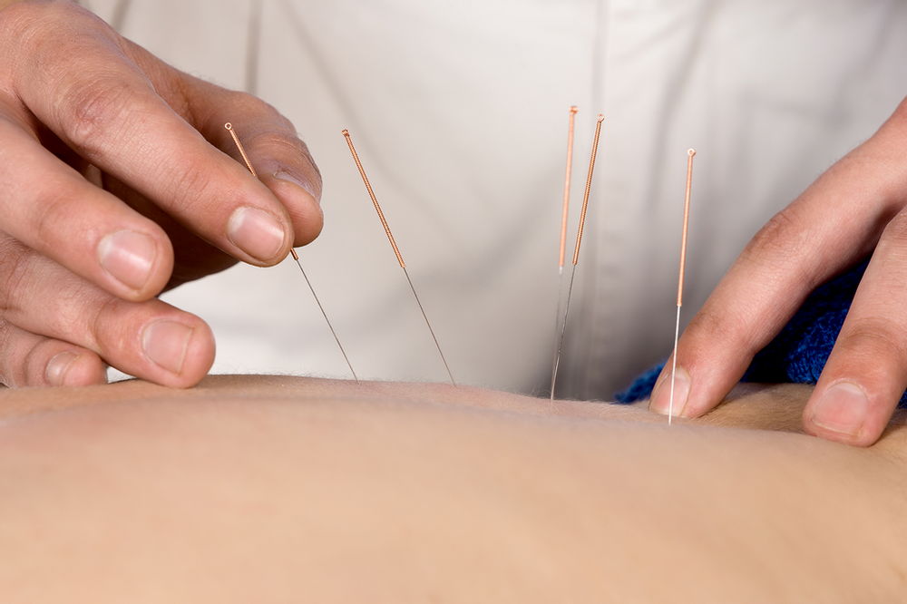 Acupuncturist Silently Invokes “Fingers Crossed” Prayer With Each Needle